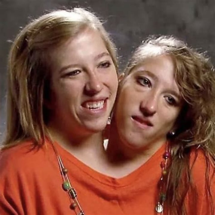 Abby and Brittany Hensel Sad News: Remembering a Remarkable Life