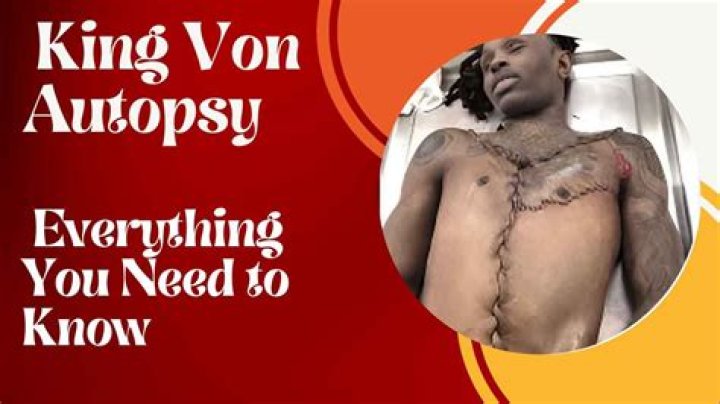 King Von Autopsy: Shocking Details Revealed